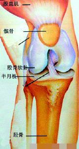 类风湿图片.jpg